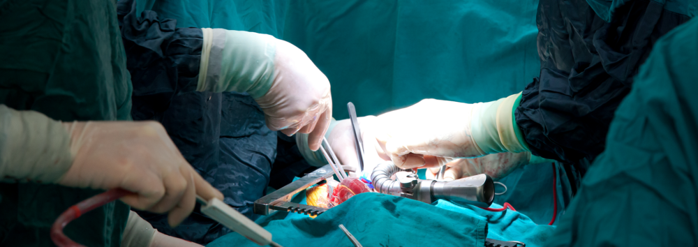 Cardio and Thoracic