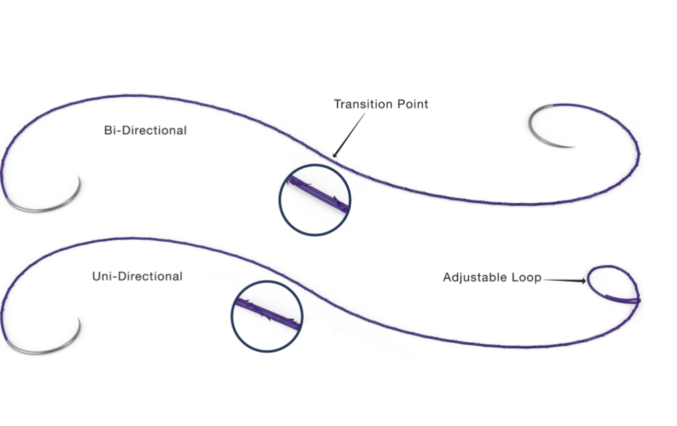 Suture configurations