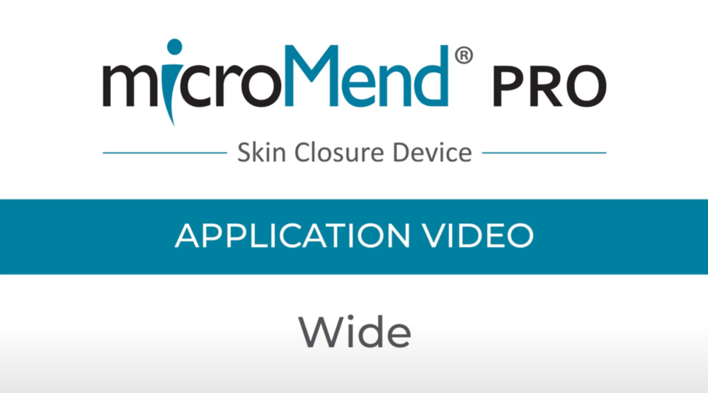 How to Apply microMend PRO: Wide - Corza Medical