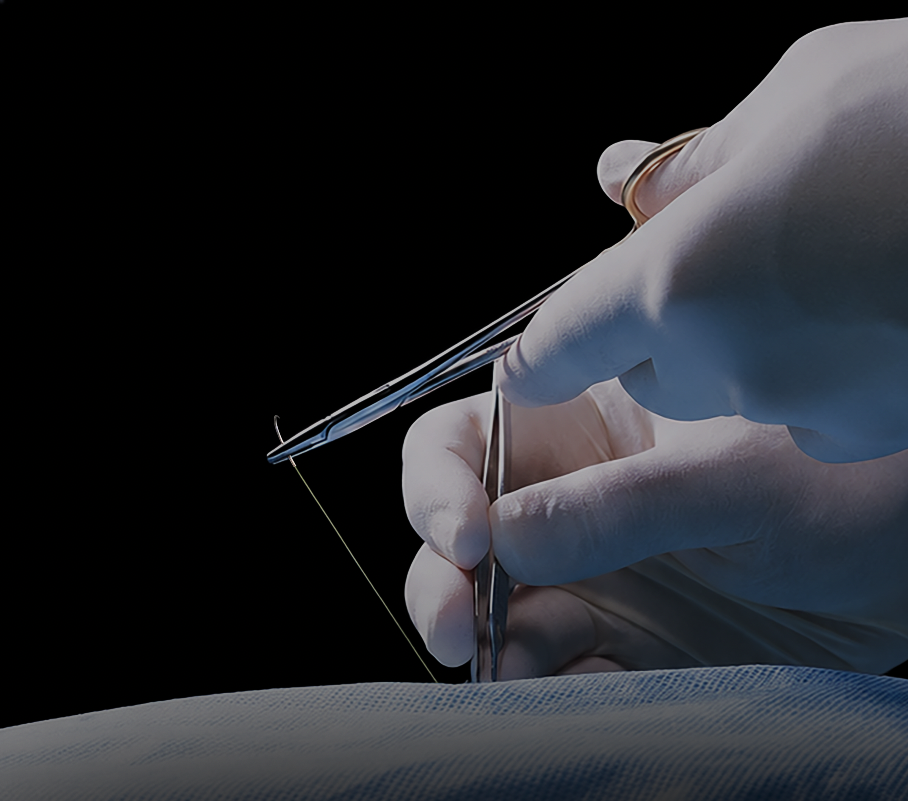 Corza Medical Expands Gut Suture Portfolio with ov...